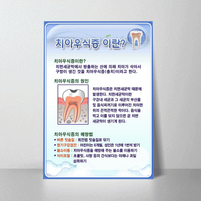 i19.치아우식증이란2