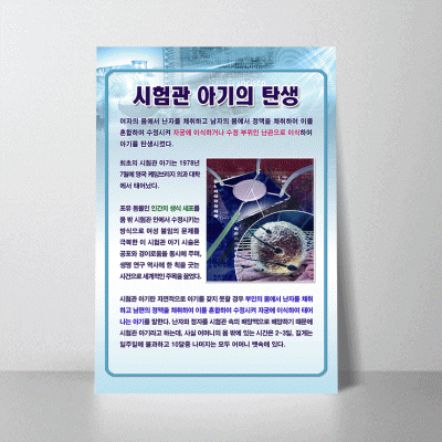 A161.시험관아기의탄생